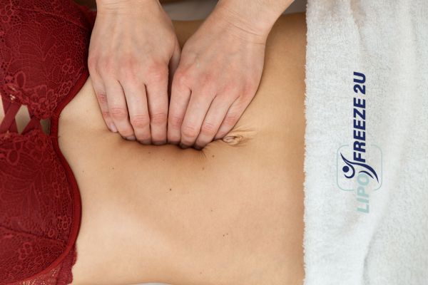 diastasis recti treatment Holmes Chapel