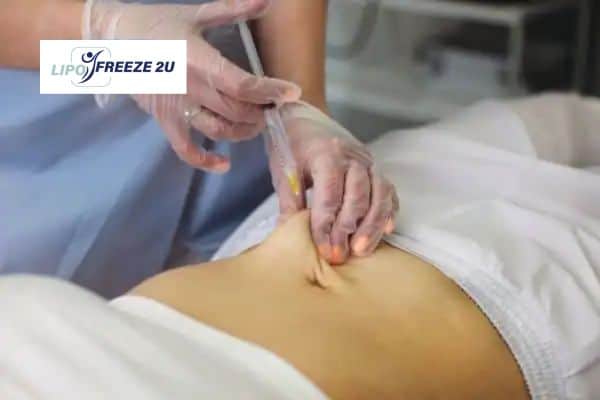 How Does Aqualyx Fat Dissolving Injection Work to Break Down Fat Holmes Chapel?