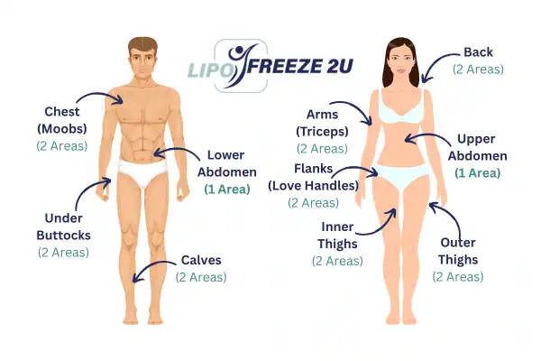 Areas you can have fat freezing treatment Holmes Chapel