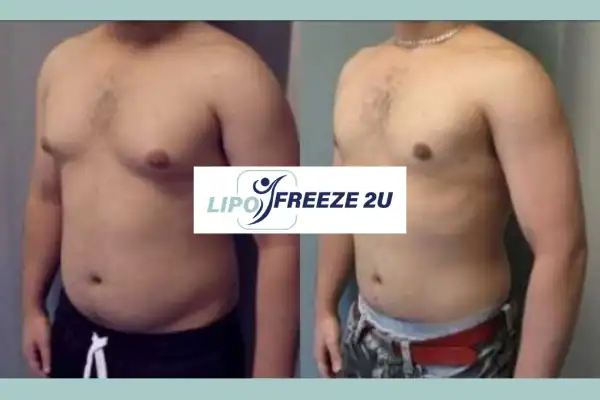 How Long Does It Take to See Results Holmes Chapel?