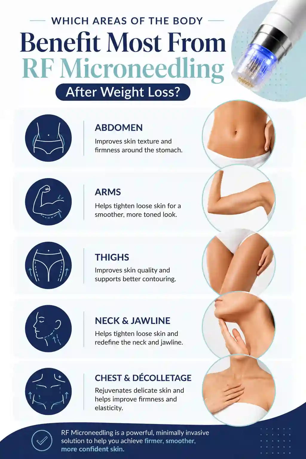 Which Areas of the Body Benefit Most From RF Microneedling After Weight Loss Holmes Chapel